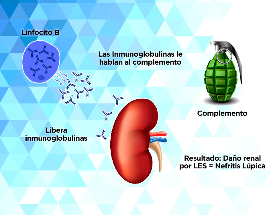 AUTOINMUNE LUPUS ANAS Y COMPLEMENTO NEFRITIS Reumatólogo en