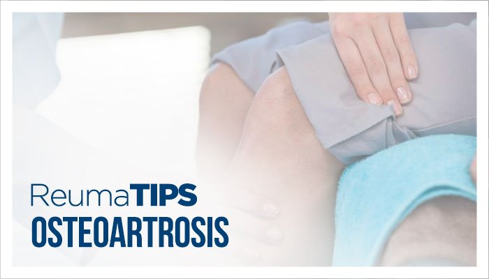 Consejos para Pacientes con Osteoartrosis